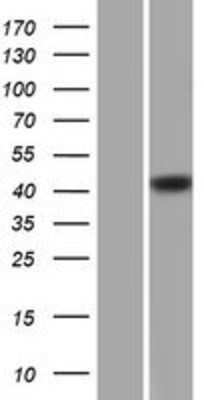 Western Blot: Centaurin alpha 1 Overexpression Lysate [NBP2-10393]