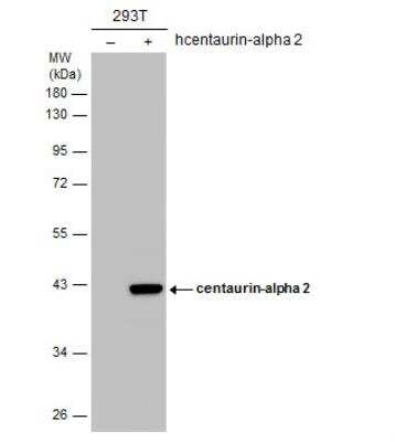 Western Blot: Centaurin alpha 2 Antibody [NBP1-31076]