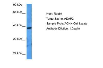 Western Blot: Centaurin alpha 2 Antibody [NBP2-86599]