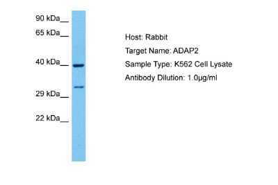 Western Blot: Centaurin alpha 2 Antibody [NBP2-86600]