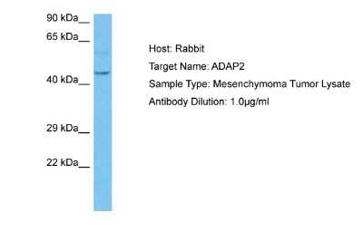 Western Blot: Centaurin alpha 2 Antibody [NBP2-86601]