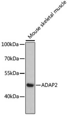 Western Blot: Centaurin alpha 2 AntibodyAzide and BSA Free [NBP2-92123]