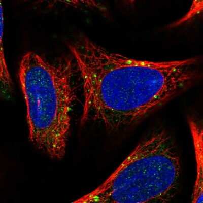 Immunocytochemistry/ Immunofluorescence: Centaurin beta 2 Antibody [NBP1-84544]