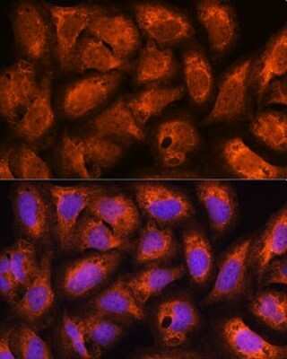 Immunocytochemistry/ Immunofluorescence: Centaurin beta 2 Antibody - Azide and BSA Free [NBP2-92701]