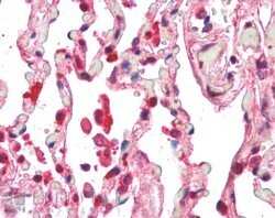 Immunohistochemistry-Paraffin: Centaurin beta 2 Antibody [NB100-1321]