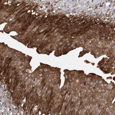 Immunohistochemistry-Paraffin: Centaurin beta 2 Antibody [NBP1-84543]