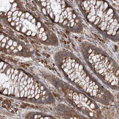Immunohistochemistry-Paraffin: Centaurin beta 2 Antibody [NBP1-84544]