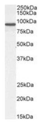 Western Blot: Centaurin beta 2 Antibody [NB100-1321]