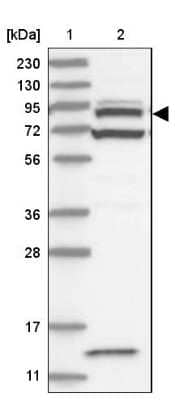 Western Blot: Centaurin beta 2 Antibody [NBP1-84543]