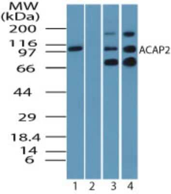 Western Blot: Centaurin beta 2 Antibody [NBP2-24528]