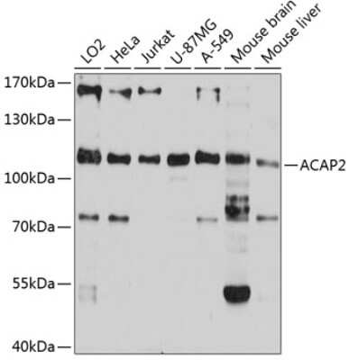 Western Blot: Centaurin beta 2 AntibodyAzide and BSA Free [NBP2-92701]