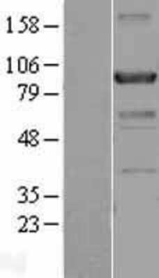 Western Blot: Centaurin beta 2 Overexpression Lysate [NBL1-09095]