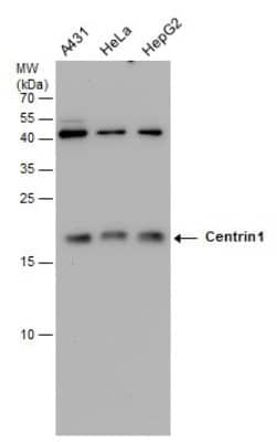 Western Blot: Centrin 1 Antibody (147) [NBP2-43803]