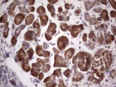Immunohistochemistry: Centrin 1 Antibody (OTI1E1) [NBP2-46253]