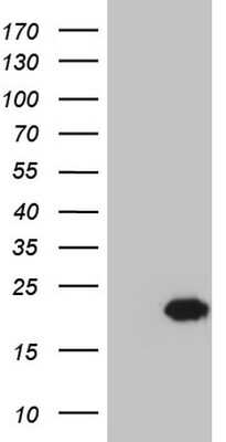 Western Blot: Centrin 1 Antibody (OTI1E1) [NBP2-46253]