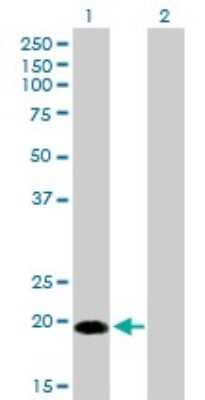 Western Blot: Centrin 1 Antibody (2A6) [H00001068-M01]