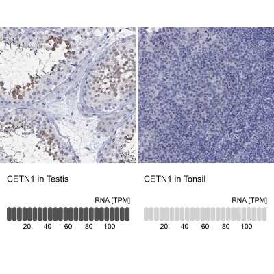 Immunocytochemistry/ Immunofluorescence: Centrin 1 Antibody [NBP3-17028]