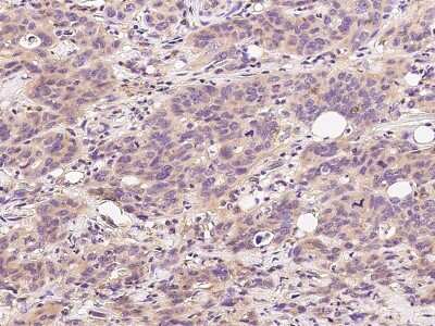 Immunohistochemistry-Paraffin: Centrin 1 Antibody [NBP2-99465]