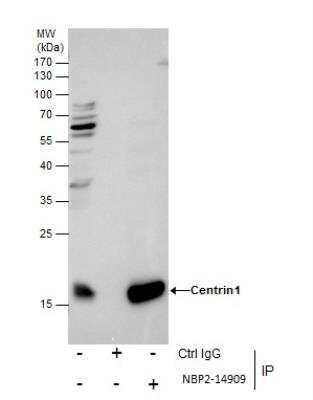 Immunoprecipitation: Centrin 1 Antibody [NBP2-14909]