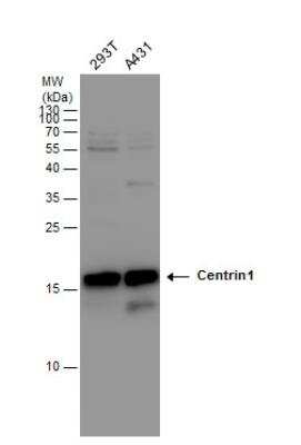 Western Blot: Centrin 1 Antibody [NBP2-14909]