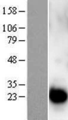 Western Blot: Centrin 1 Overexpression Lysate [NBL1-09115]