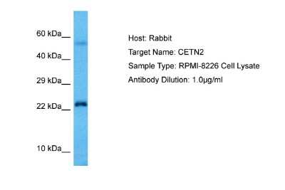 Western Blot: Centrin 2 Antibody [NBP2-86603]