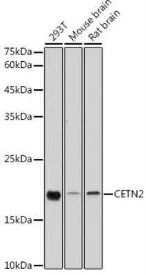 Western Blot: Centrin 2 AntibodyAzide and BSA Free [NBP2-92653]