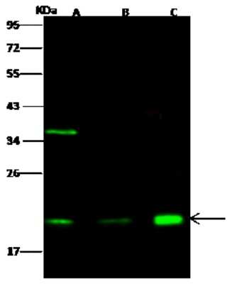 Western Blot: Centrin 2 Antibody [NBP2-96991]