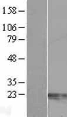 Western Blot: Centrin 2 Overexpression Lysate [NBL1-09116]