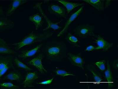 Immunocytochemistry/ Immunofluorescence: Centrin 3 Antibody [H00001070-B01P]