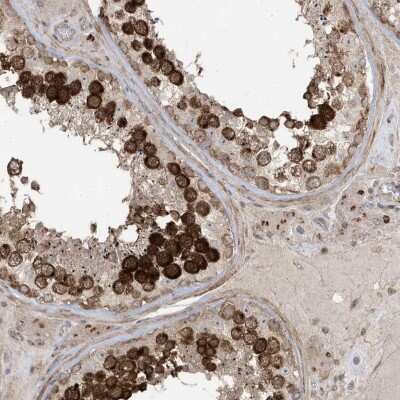 Immunohistochemistry-Paraffin: Centrin 3 Antibody [NBP1-84547]