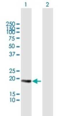 Western Blot: Centrin 3 Antibody [H00001070-B01P]