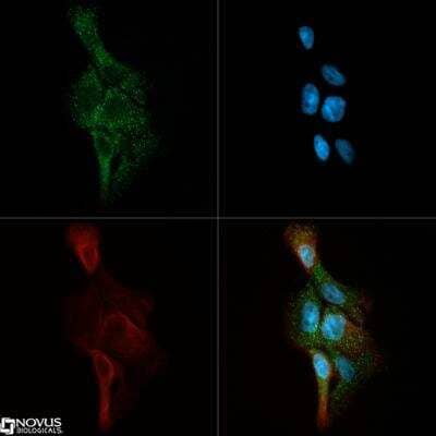 Immunocytochemistry/ Immunofluorescence: Ceramide Kinase Antibody [NB100-2911]