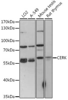 Western Blot: Ceramide Kinase AntibodyAzide and BSA Free [NBP2-92271]