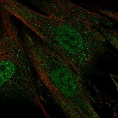 Immunocytochemistry/ Immunofluorescence: Ceramide Kinase Like Antibody [NBP2-58304]