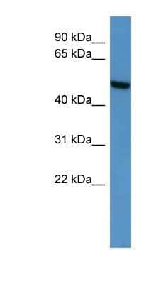 Western Blot: Ceramide Kinase Like Antibody [NBP1-68988]