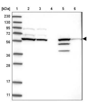 Western Blot: Ceramide Kinase Like Antibody [NBP1-87115]