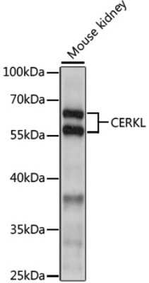 Western Blot: Ceramide Kinase Like AntibodyAzide and BSA Free [NBP2-92288]