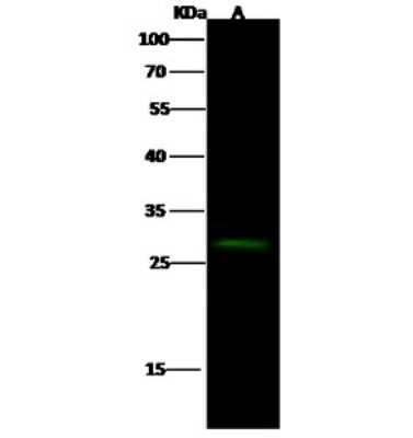 Western Blot: Cerberus 1 Antibody [NBP2-99622]