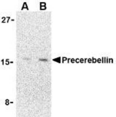 Western Blot: Cerebellin-1/Precerebellin AntibodyBSA Free [NBP1-77238]