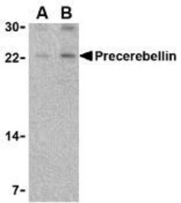 Western Blot: Cerebellin-1/Precerebellin AntibodyBSA Free [NBP1-77239]