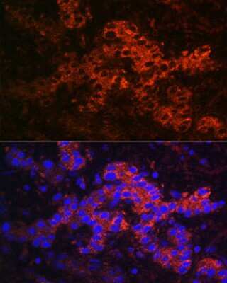 Immunohistochemistry: Ceruloplasmin Antibody - Azide and BSA Free [NBP3-03563]