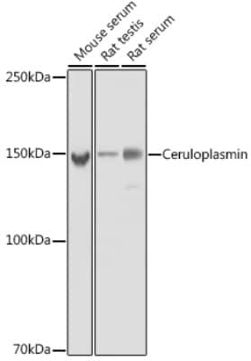 Western Blot: Ceruloplasmin Antibody (6C3K9) [NBP3-15868]