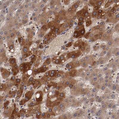 Immunohistochemistry-Paraffin: Ceruloplasmin Antibody [NBP1-88116]