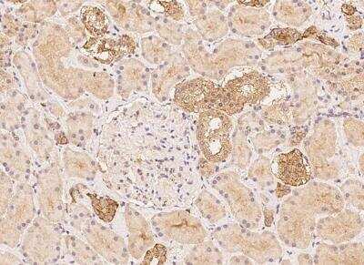 Immunohistochemistry-Paraffin: Ceruloplasmin Antibody [NBP3-05810]