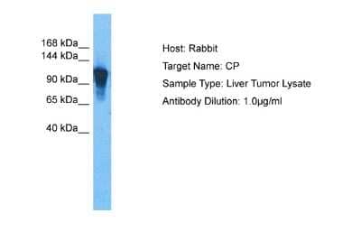 Western Blot: Ceruloplasmin Antibody [NBP2-82663]