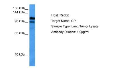 Western Blot: Ceruloplasmin Antibody [NBP2-82664]