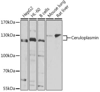 Western Blot: Ceruloplasmin AntibodyAzide and BSA Free [NBP2-92507]