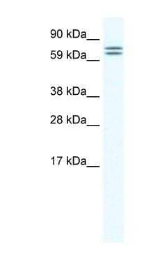 Western Blot: Ces2a Antibody [NBP1-91620]