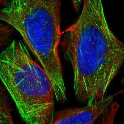 Immunocytochemistry/ Immunofluorescence: ChGn Antibody [NBP2-56242]